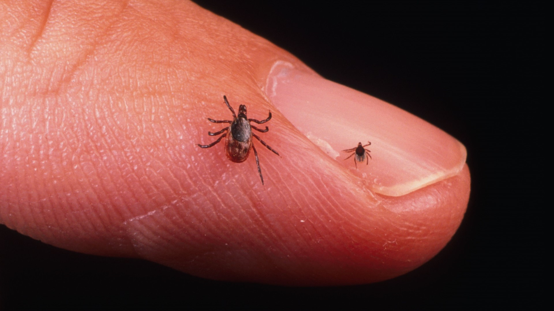 Officials: Lyme disease case confirmed in Michigan | WZZM13.com